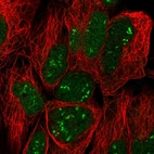 Anti-TRO Antibody