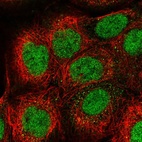 Immunofluorescent staining of human cell line A-431 shows localization to nucleoplasm.