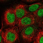 Immunofluorescent staining of human cell line A-431 shows localization to nucleoplasm.