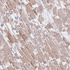 Anti-PLA2G5 Antibody