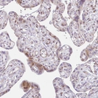 Immunohistochemical staining of human placenta shows weak extracellular space positivity in subset of trophoblastic cells.