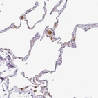 Immunohistochemical staining of human lung shows strong granular cytoplasmic positivity in subset of macrophages.