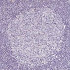 Anti-PLA2G5 Antibody
