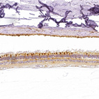 Anti-PLA2G5 Antibody