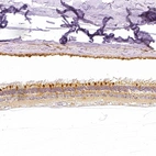 Immunohistochemical staining of human eye, retina shows moderate cytoplasmic positivity in photoreceptor cells.