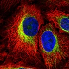 Anti-PTPN18 Antibody