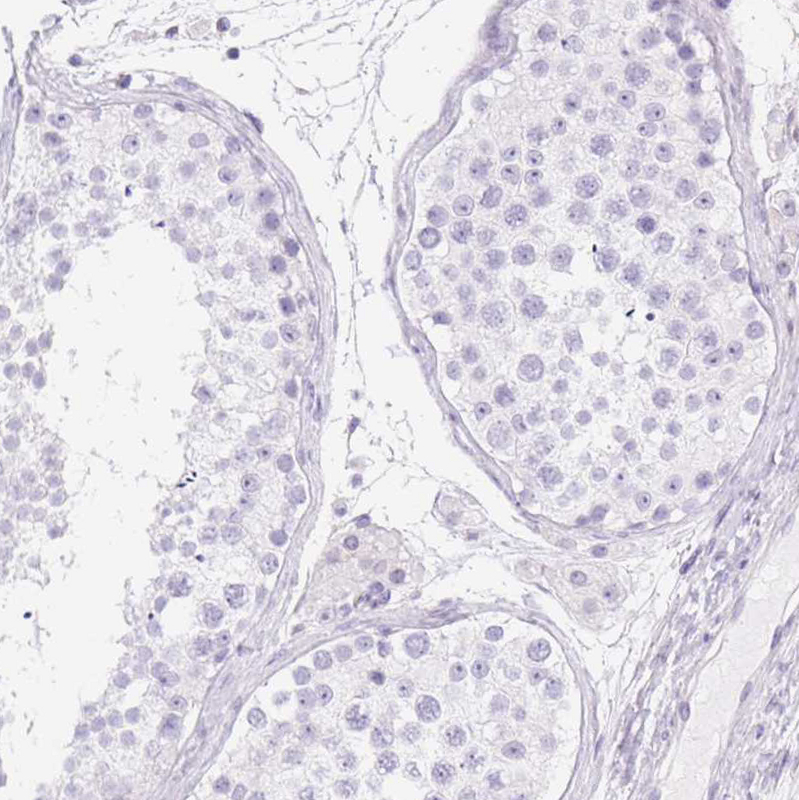 Rabbit Polyclonal AntiCYP21A2 Antibody Buy for research Highly