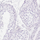 Immunohistochemical staining of human testis shows no positivity in cells in seminiferous ducts as expected.