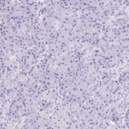 Immunohistochemical staining of human pancreas shows no positivity in exocrine glandular cells as expected.