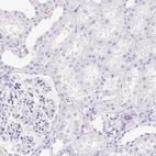 Immunohistochemical staining of human kidney shows no positivity in cells in tubules as expected.