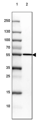 Lane 1: Marker [kDa] 250, 130, 100, 70, 55, 35, 25, 15, 10_br/_Lane 2: Human Adrenal Gland tissue