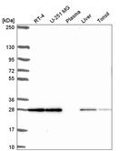 Anti-TMEM98 Antibody