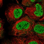 Immunofluorescent staining of human cell line HEK 293 shows localization to nucleoplasm.