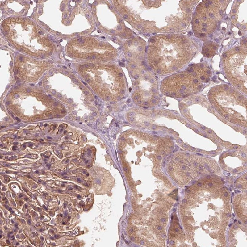 Anti-OTOGL Antibody