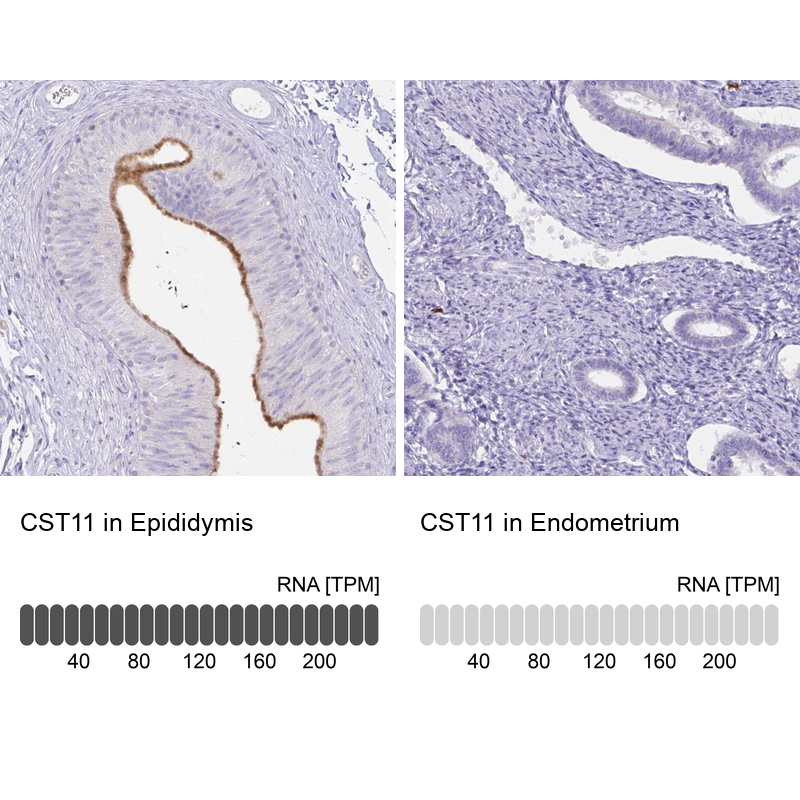 Anti-CST11 Antibody