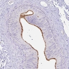 Immunohistochemical staining of human epididymis shows high expression.