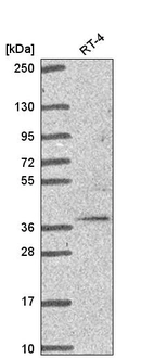 Western blot analysis in human cell line RT-4.