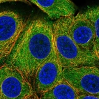 Immunofluorescent staining of human cell line MCF7 shows localization to cytosol.