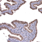 Immunohistochemical staining of human fallopian tube shows moderate nuclear positivity in glandular cells.