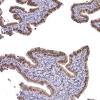 Immunohistochemical staining of human fallopian tube shows moderate nuclear positivity in glandular cells.