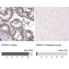 Immunohistochemistry analysis in human testis and skeletal muscle tissues using HPA053406 antibody. Corresponding BTBD7 RNA-seq data are presented for the same tissues.