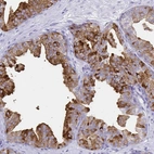 Anti-TIMP1 Antibody