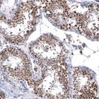 Immunohistochemical staining of human testis shows moderate to strong nuclear positivity in cells in seminiferous ducts.