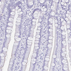 Immunohistochemical staining of human duodenum shows no positivity in glandular cells as expected.