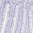 Immunohistochemical staining of human duodenum shows no positivity in glandular cells as expected.