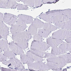 Immunohistochemical staining of human skeletal muscle shows no positivity in myocytes as expected.