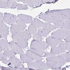 Immunohistochemical staining of human skeletal muscle shows no positivity in myocytes as expected.