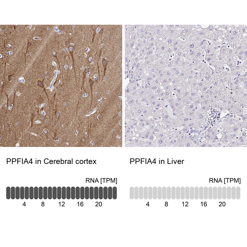 Anti-PPFIA4 Antibody