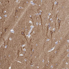 Immunohistochemical staining of human cerebral cortex shows strong cytoplasmic positivity in neurons.