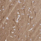 Immunohistochemical staining of human cerebral cortex shows strong cytoplasmic positivity in neurons.