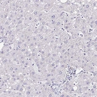 Immunohistochemical staining of human liver shows no positivity in hepatocytes as expected.