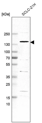 Western blot analysis in human cell line SCLC-21H.
