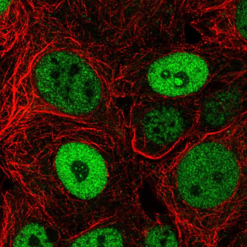 Anti-BCL9L Antibody