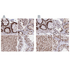 Anti-HDGF Antibody