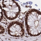 Immunohistochemical staining of human colon using Anti-HDGF antibody HPA053422.