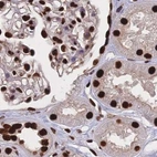 Immunohistochemical staining of human kidney using Anti-HDGF antibody HPA053422.
