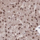 Anti-HDGF Antibody