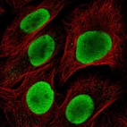 Immunofluorescent staining of human cell line U-2 OS shows localization to nucleoplasm.