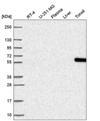 Western blot analysis in human cell line RT-4, human cell line U-251 MG, human plasma, human liver tissue and human tonsil tissue.