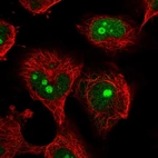 Immunofluorescent staining of human cell line U-251 MG shows localization to nucleus & nucleoli.