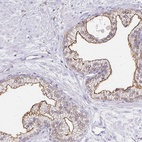 Anti-TAS1R3 Antibody