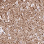 Anti-EMC4 Antibody