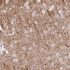 Anti-EMC4 Antibody