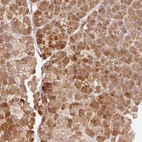 Anti-RGL2 Antibody