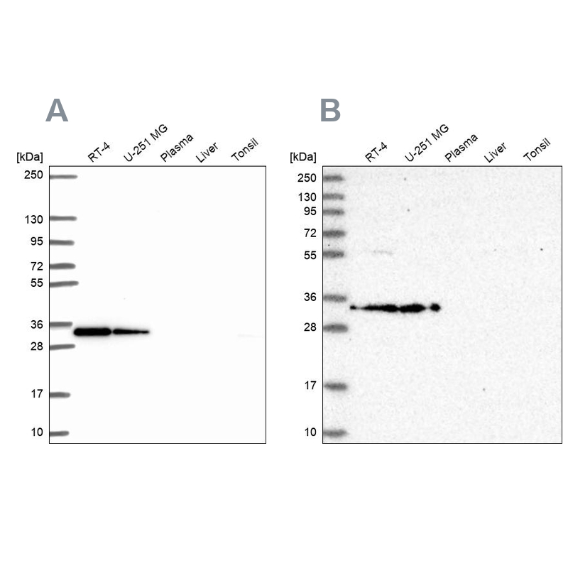 Anti-RPS3A Antibody