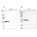 Anti-RPS3A Antibody